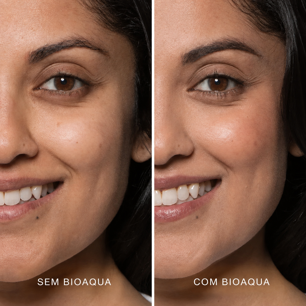 Base Profissional - BioAqua™ [Compre 1 Leve 2] + Brindes